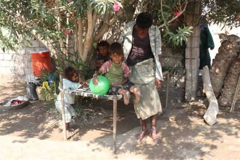 في يومهم العالمي.. أطفال الحديدة ضحايا ألغام الإرهاب الحوثي