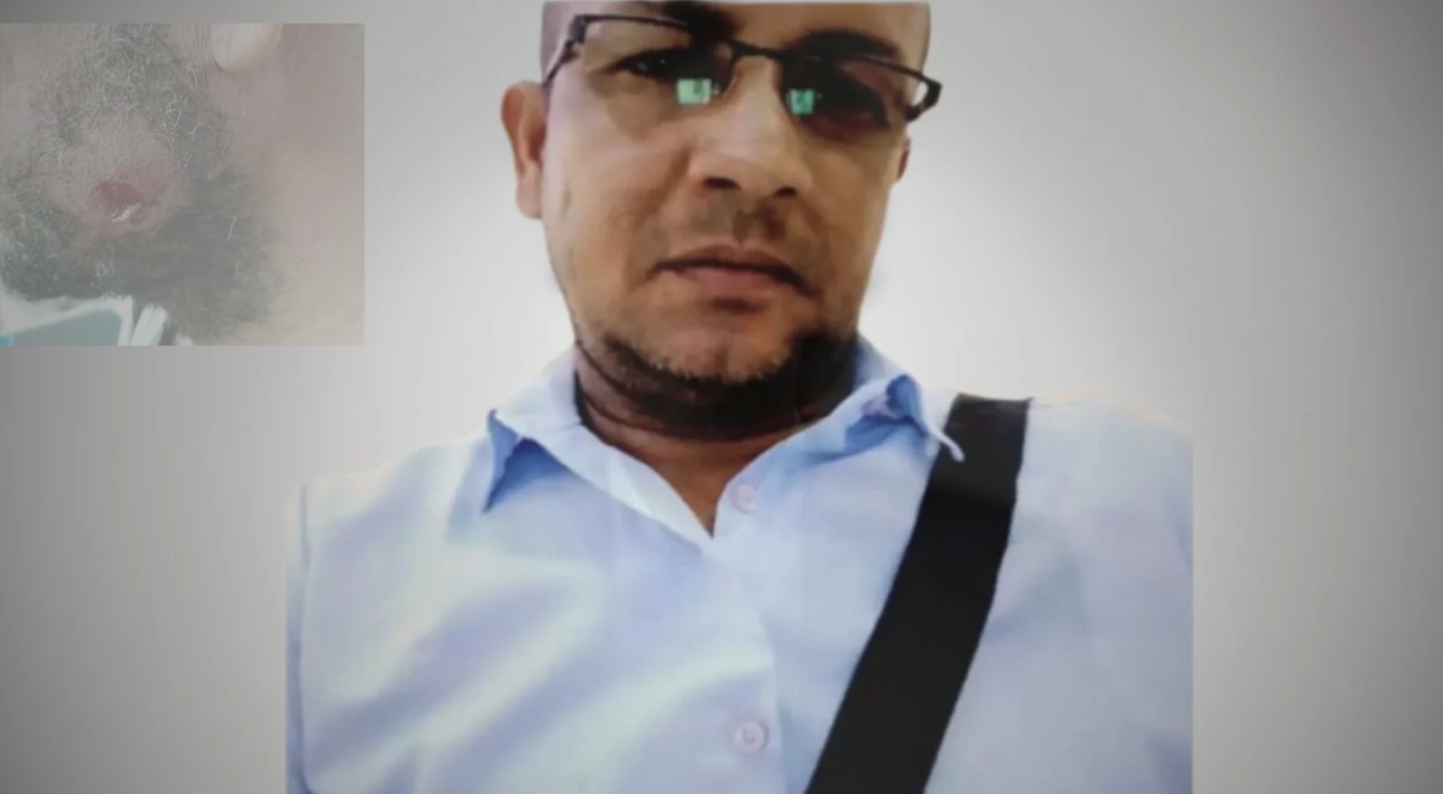 اتهمه بالعمل ضد الانتقالي «المُنحل».. مسلح يعتدي على صحفي أثناء توثيقه تحسن الأوضاع في لحج